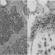 The ball-shaped enterovirus D68, seen above in two electron microscope images, is one of the primary suspected causes of AFM.